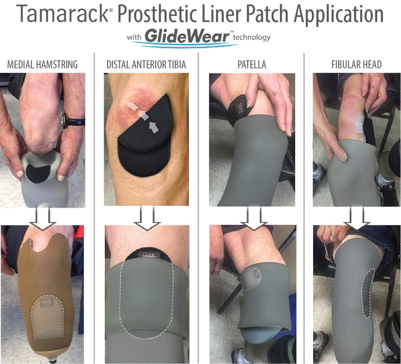 GlideWear Tamarack Prosthetic Liner Patch with GlideWear Technology for Amputees (4" Circles, 2 Pack) - Image 3